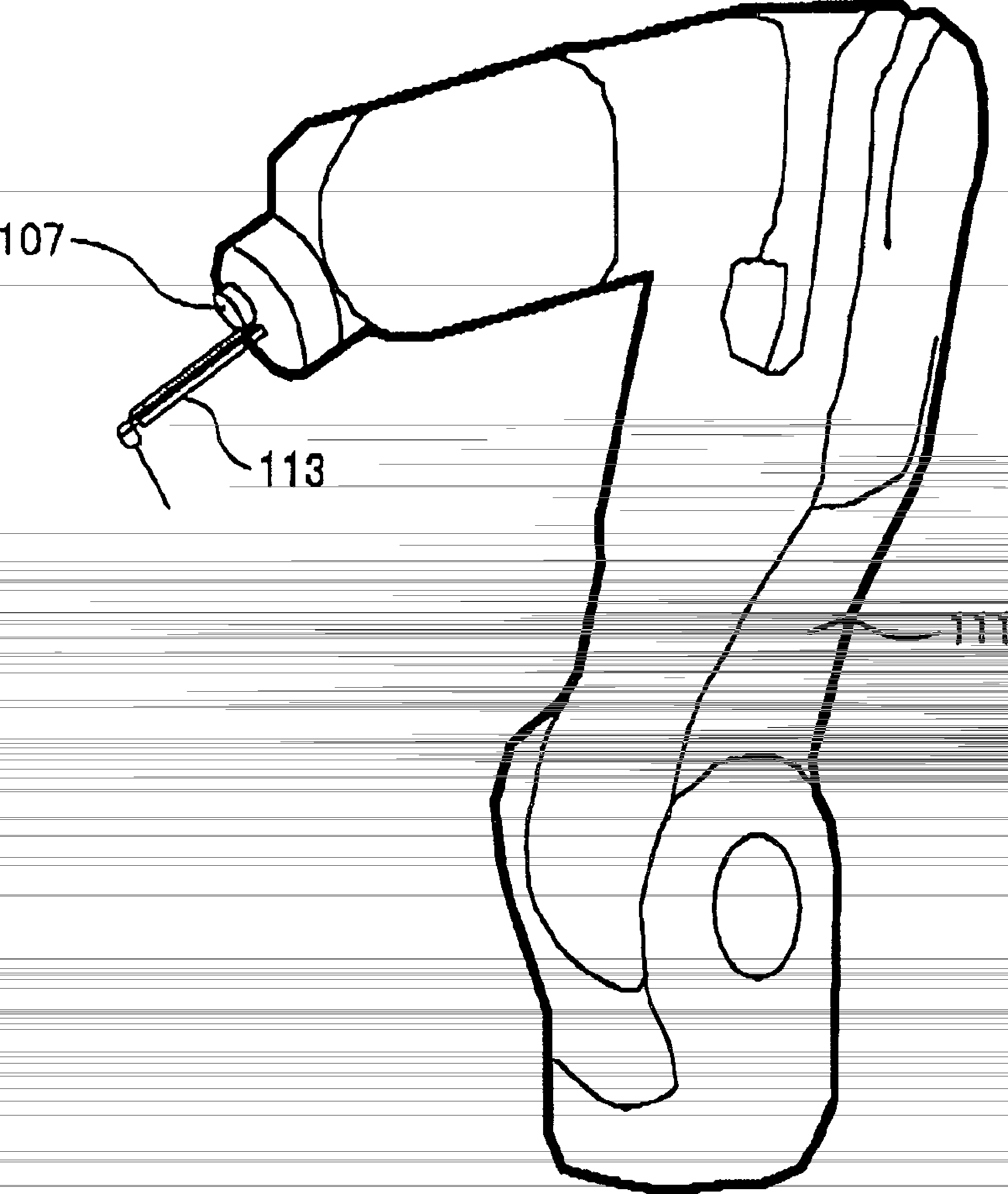 Method and apparatus for supporting dental implantation surgery