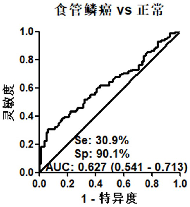 Application of PAIP1 autoantibody in auxiliary diagnosis of esophageal squamous carcinoma