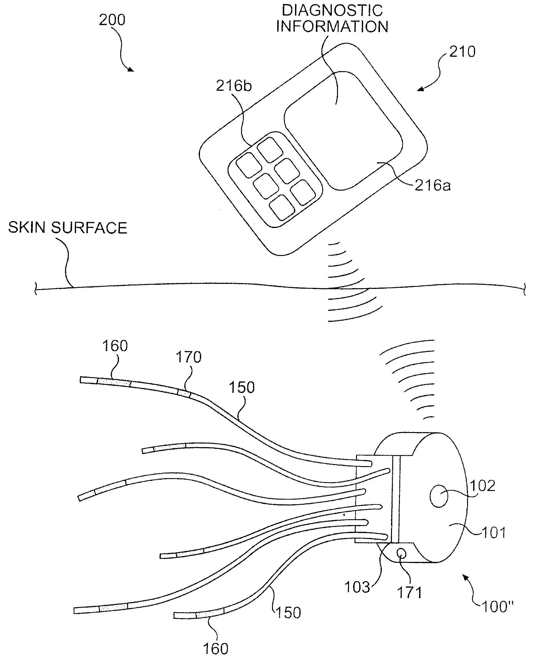 Nerve regeneration system and lead devices associated therewith