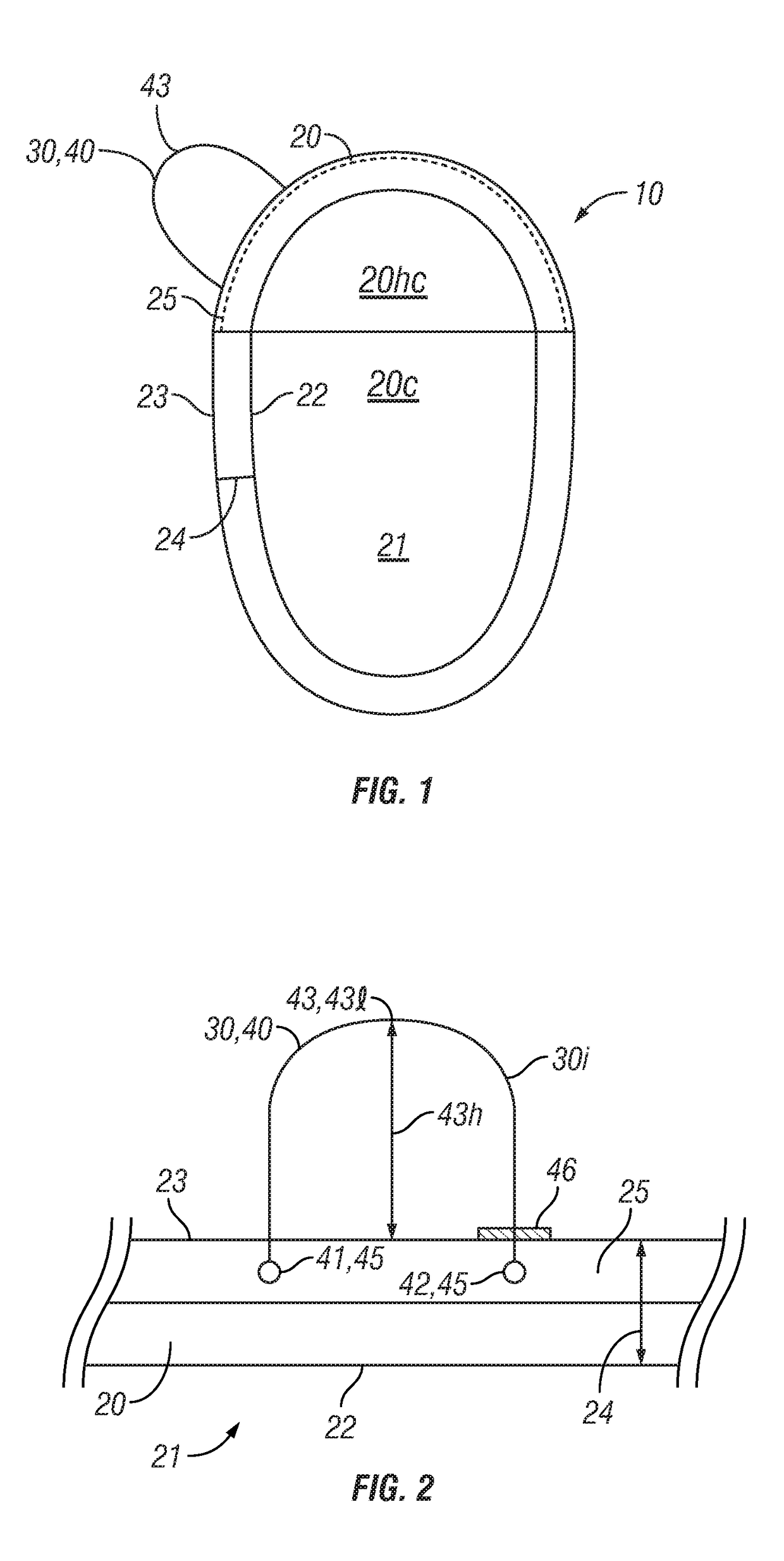 Medical implant housing having attached suture anchors