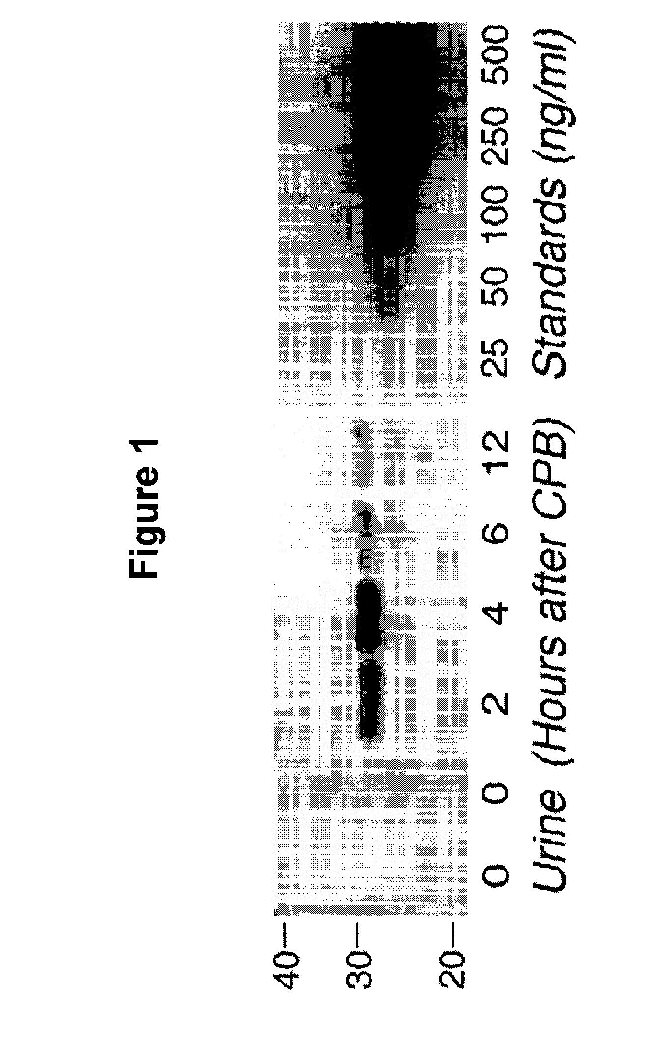 Method for the early detection of renal injury
