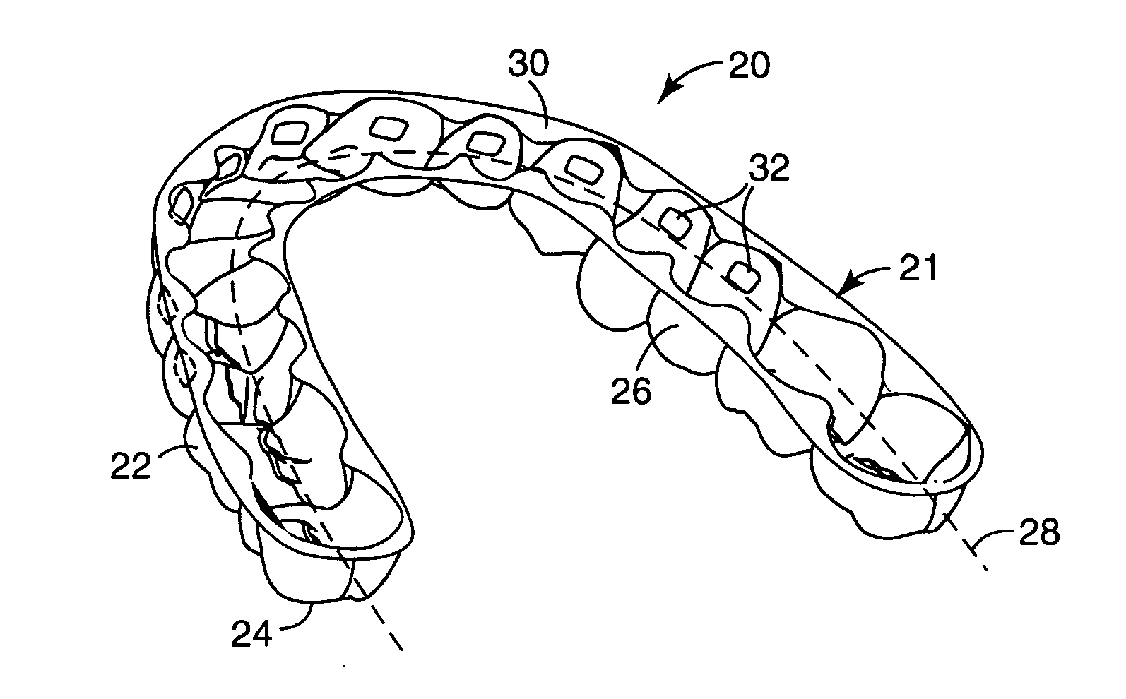 Orthodontic methods and apparatus for applying a composition to a patient's teeth