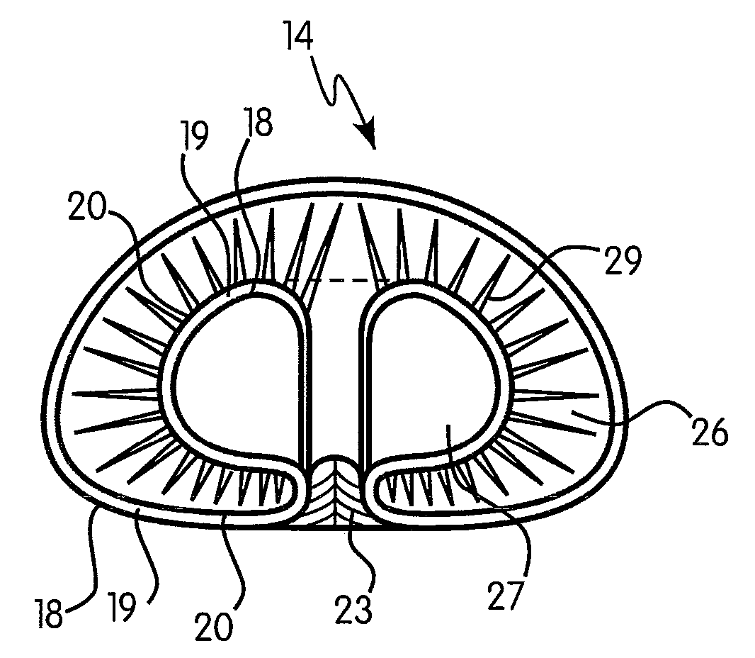 Adjustable implant with self-sealing elastomeric membrane and methods of fabrication thereof