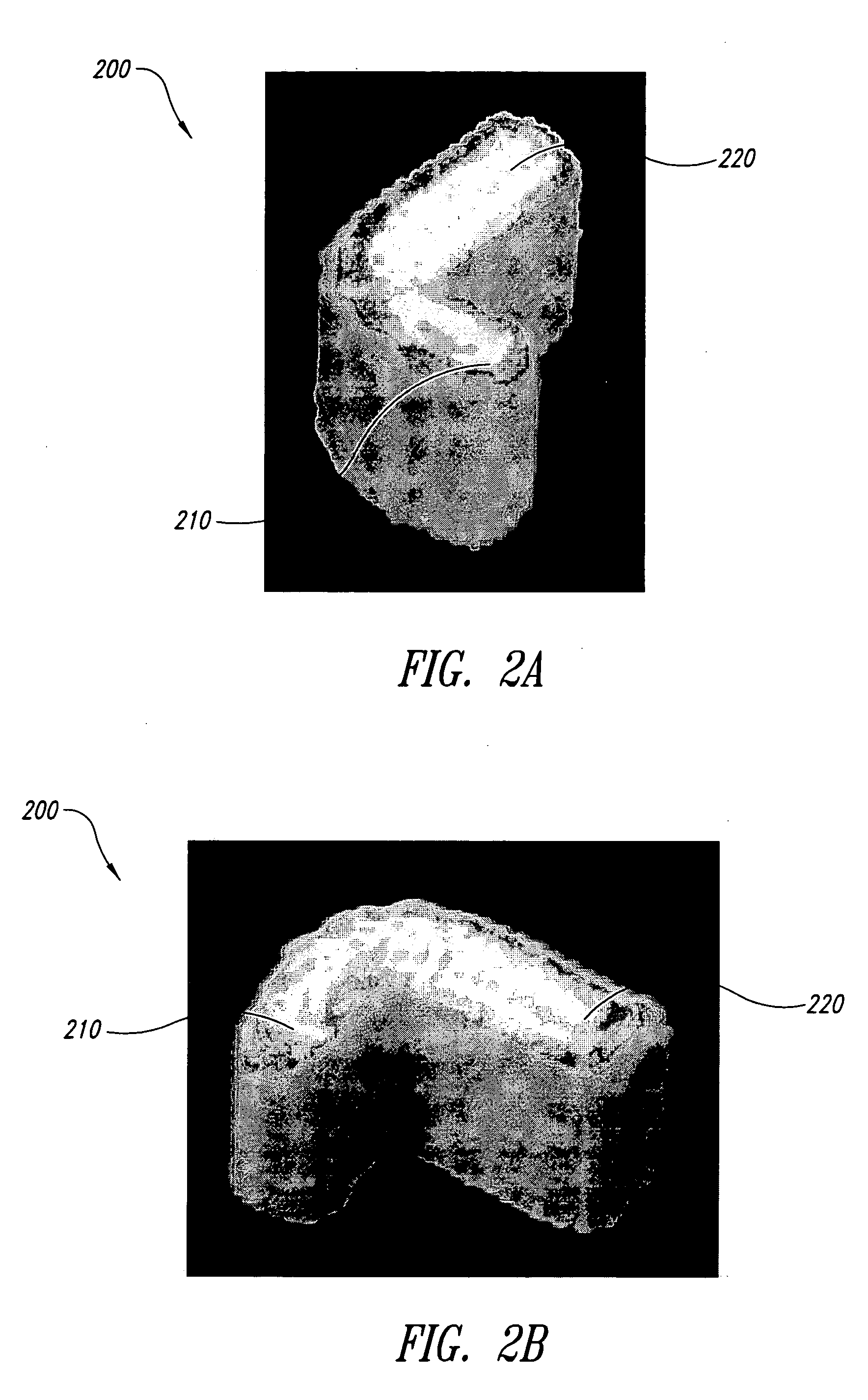 Method of manufacture, installation, and system for an alveolar ridge augmentation graft