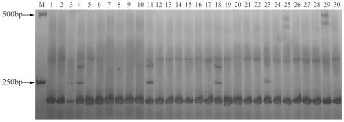 Vicia sativa ILP molecular marker primers and application thereof in variety identification
