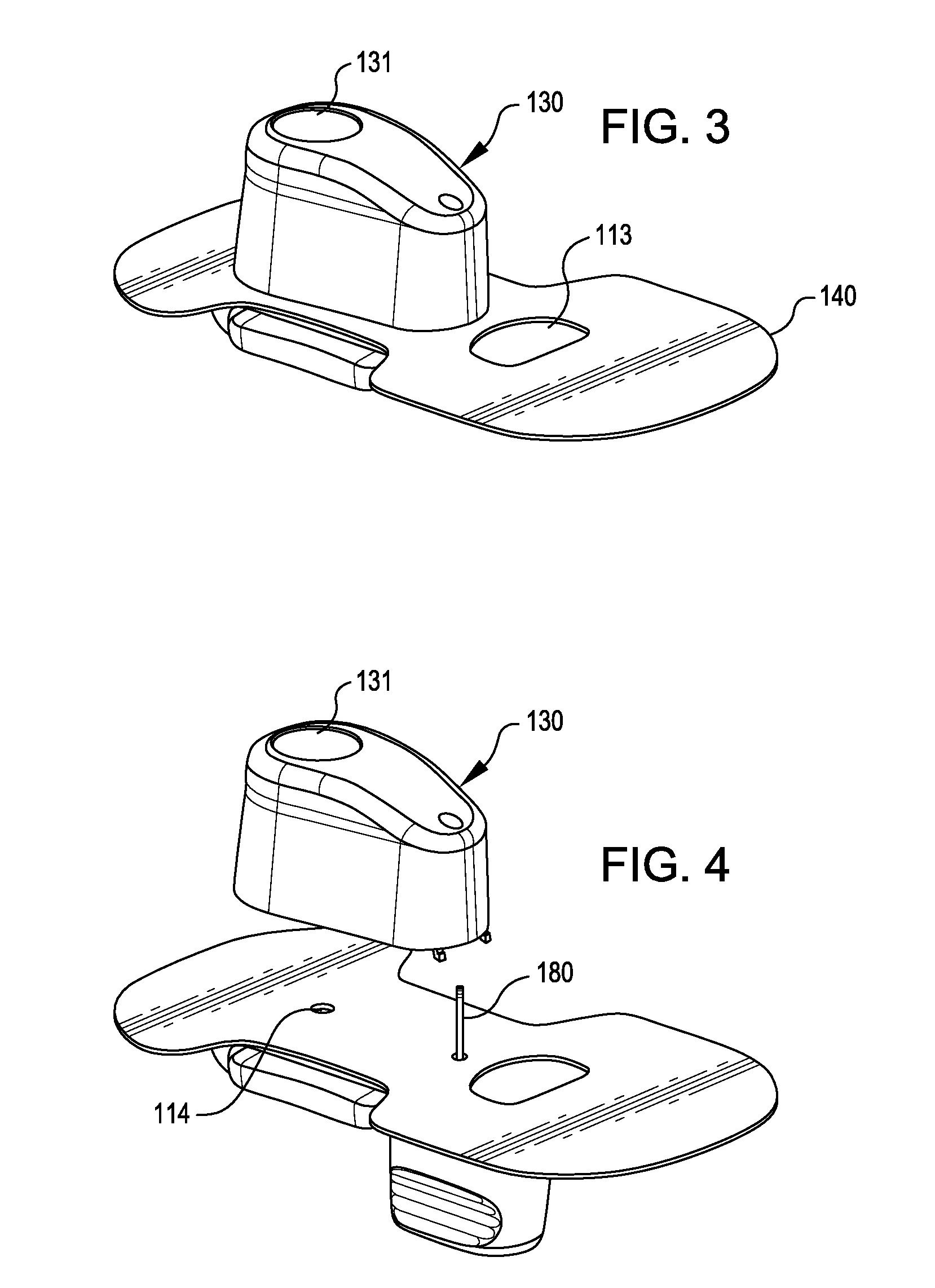 Wearable infusion device and system