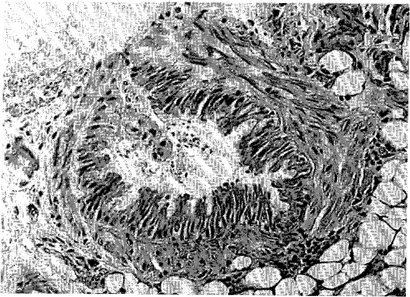 Smoke exposure device used for establishing chronic obstructive pulmonary disease model