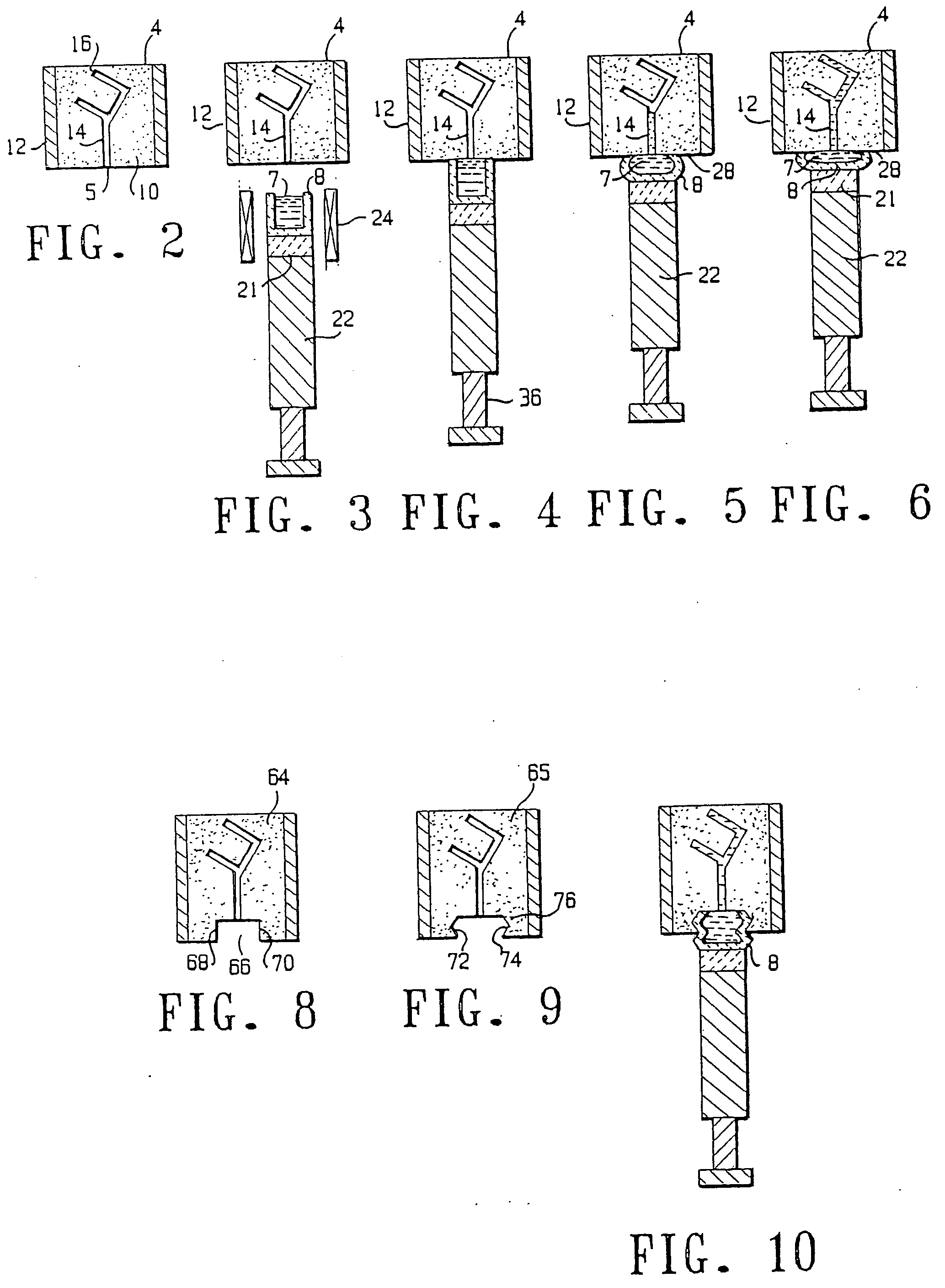Method for molding dental restorations and related apparatus