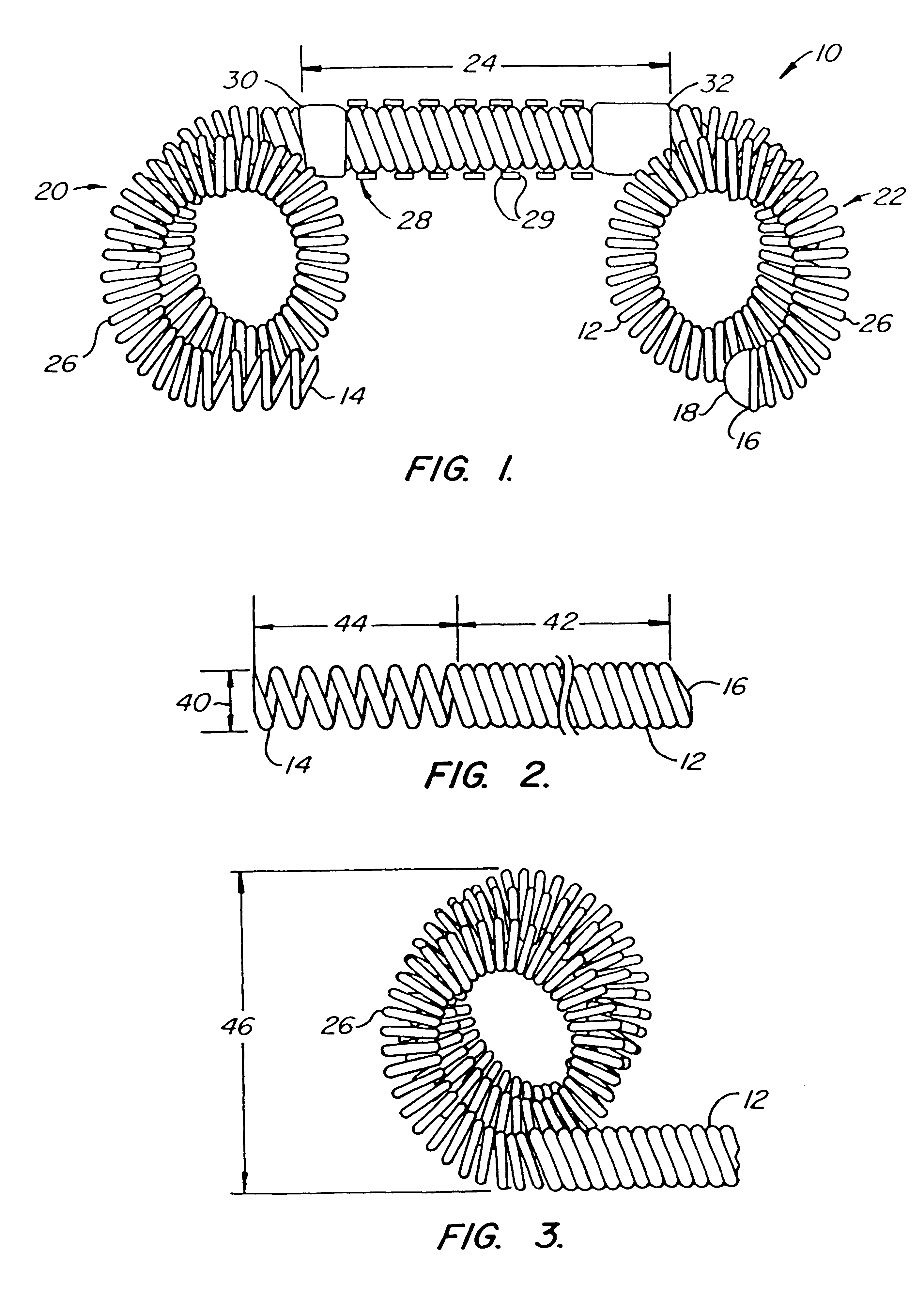 Contraceptive transcervical fallopian tube occlusion devices and methods
