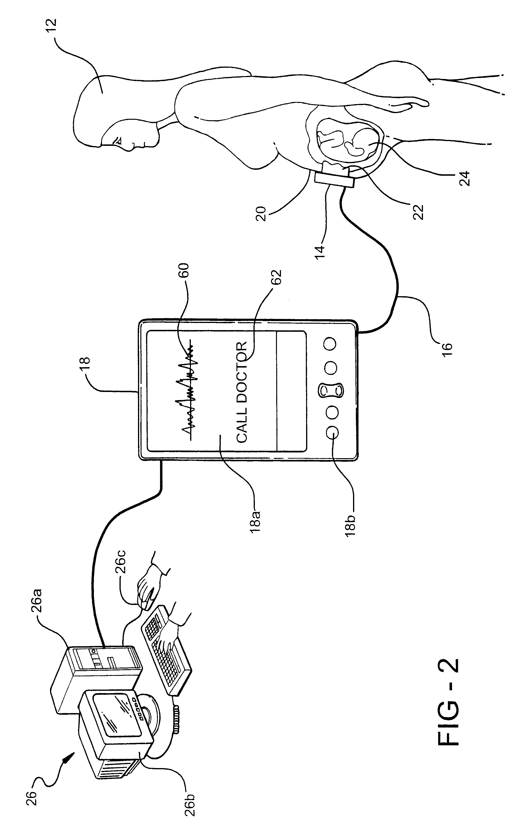 System and method for remote pregnancy monitoring