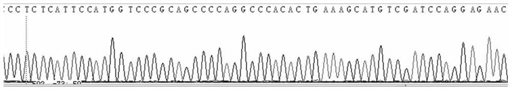 Method, kit, oligonucleotide and application thereof for detecting pklr gene mutation
