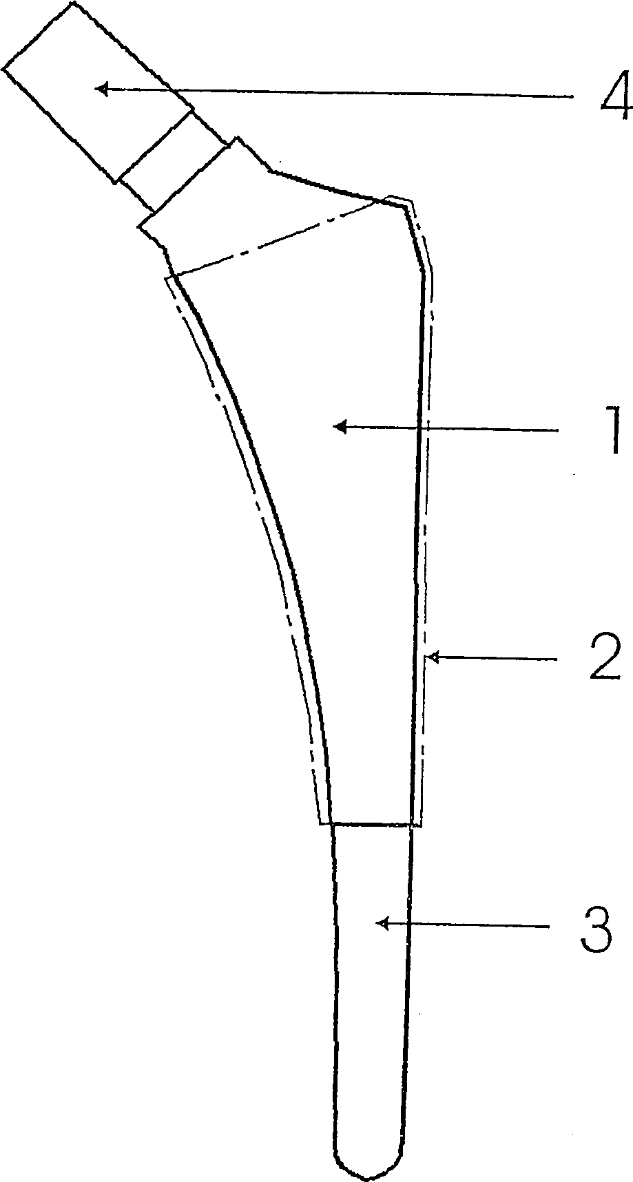 Body joint replacement titanium implant comprising one or several base bodies