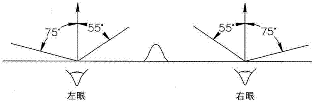 Method and system for treatment of visual impairment