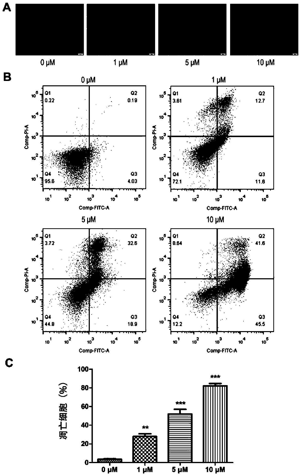 ACC inhibitor and medical application thereof