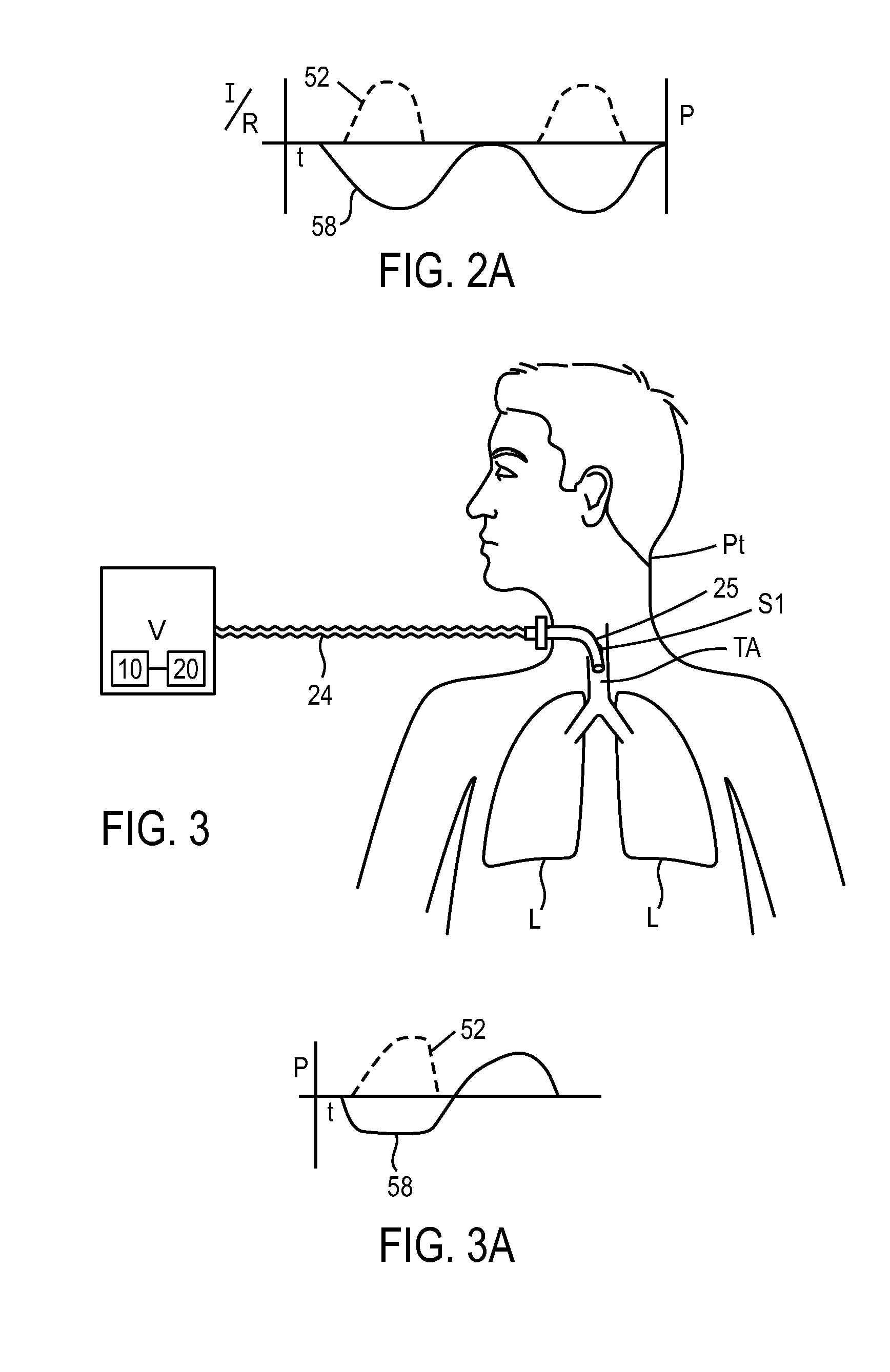 Methods and devices for sensing respiration and controlling ventilator functions