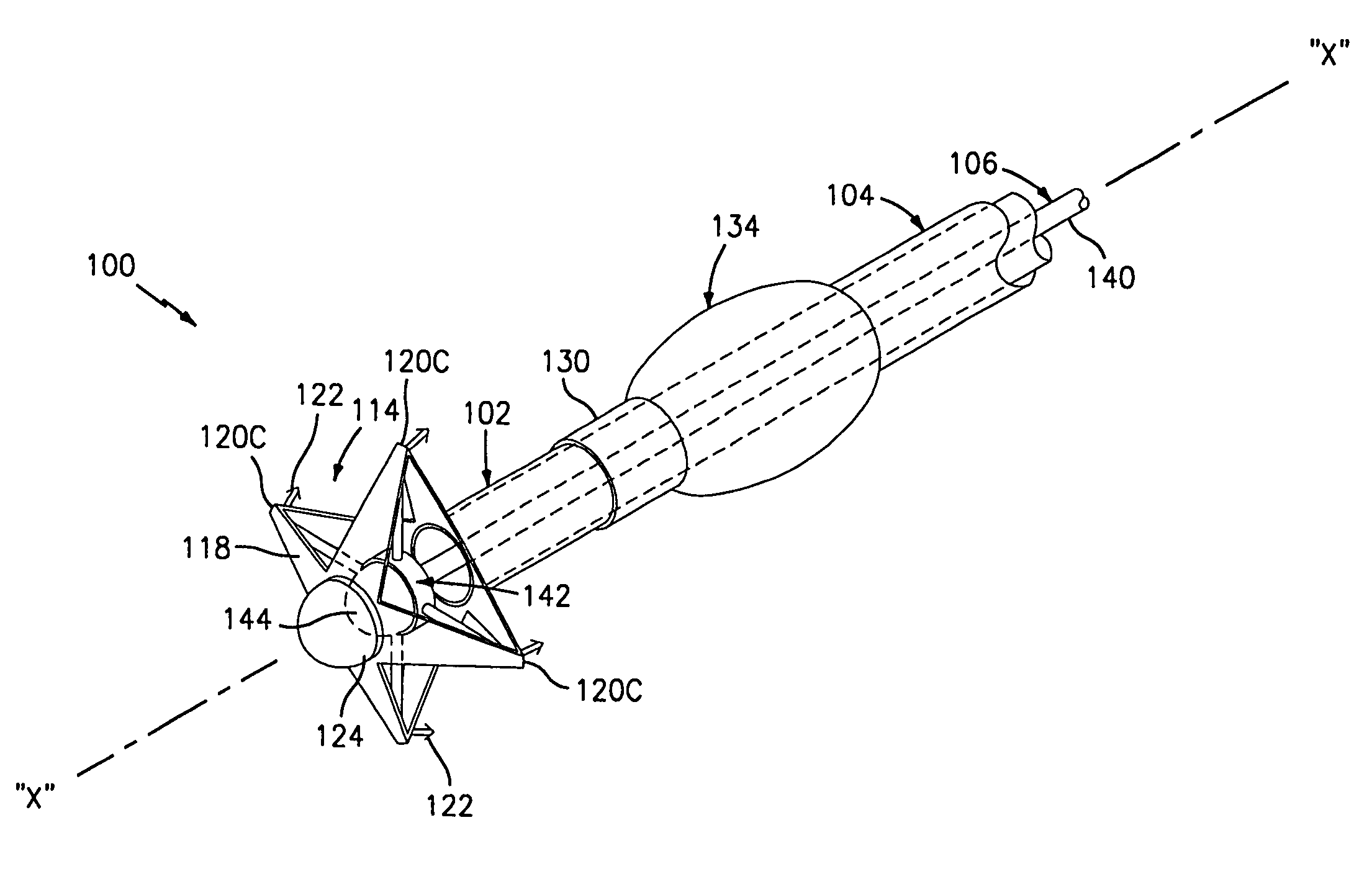 Method and apparatus for anastomosis including an anchoring sleeve