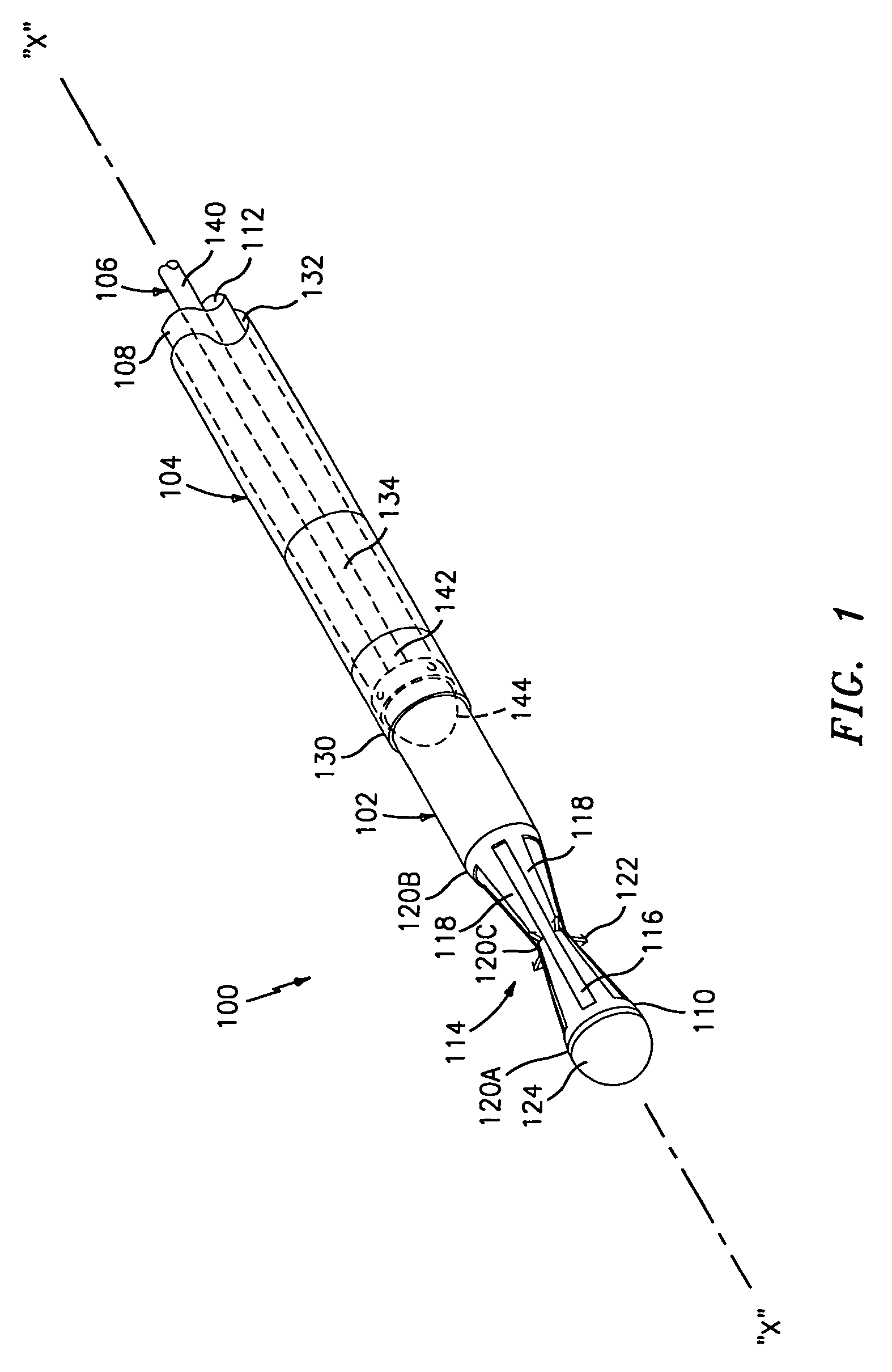 Method and apparatus for anastomosis including an anchoring sleeve