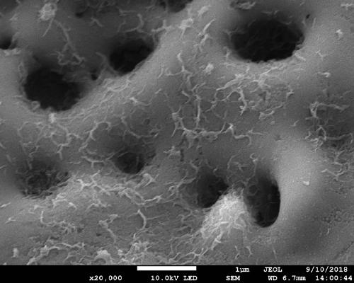 Degradable magnesium alloy bone nail with squamous bionic bone nanostructure coating and preparation method