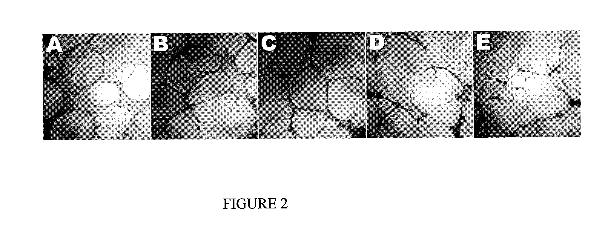 Method for treatment of diseases