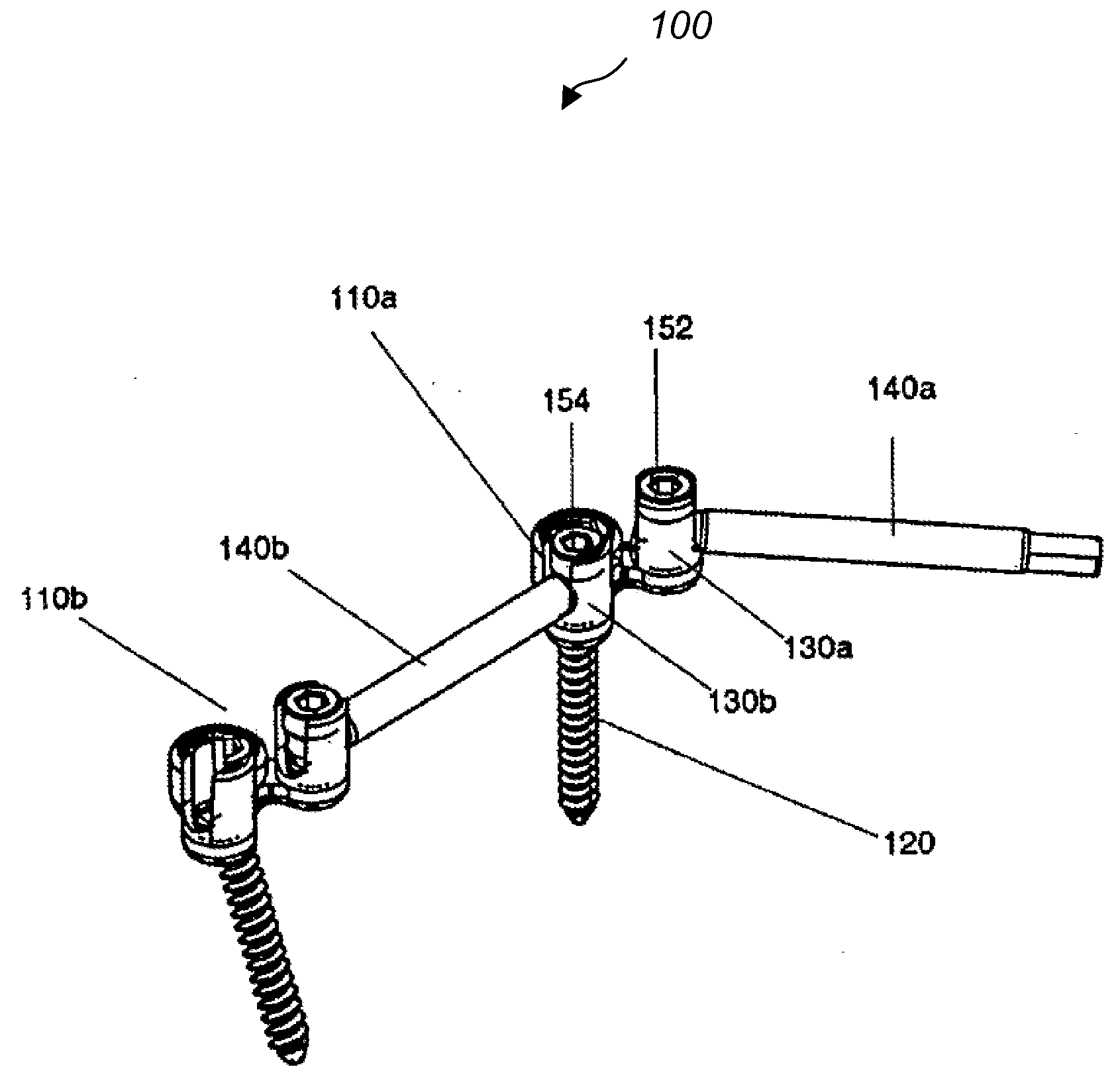Spine fixation method and apparatus