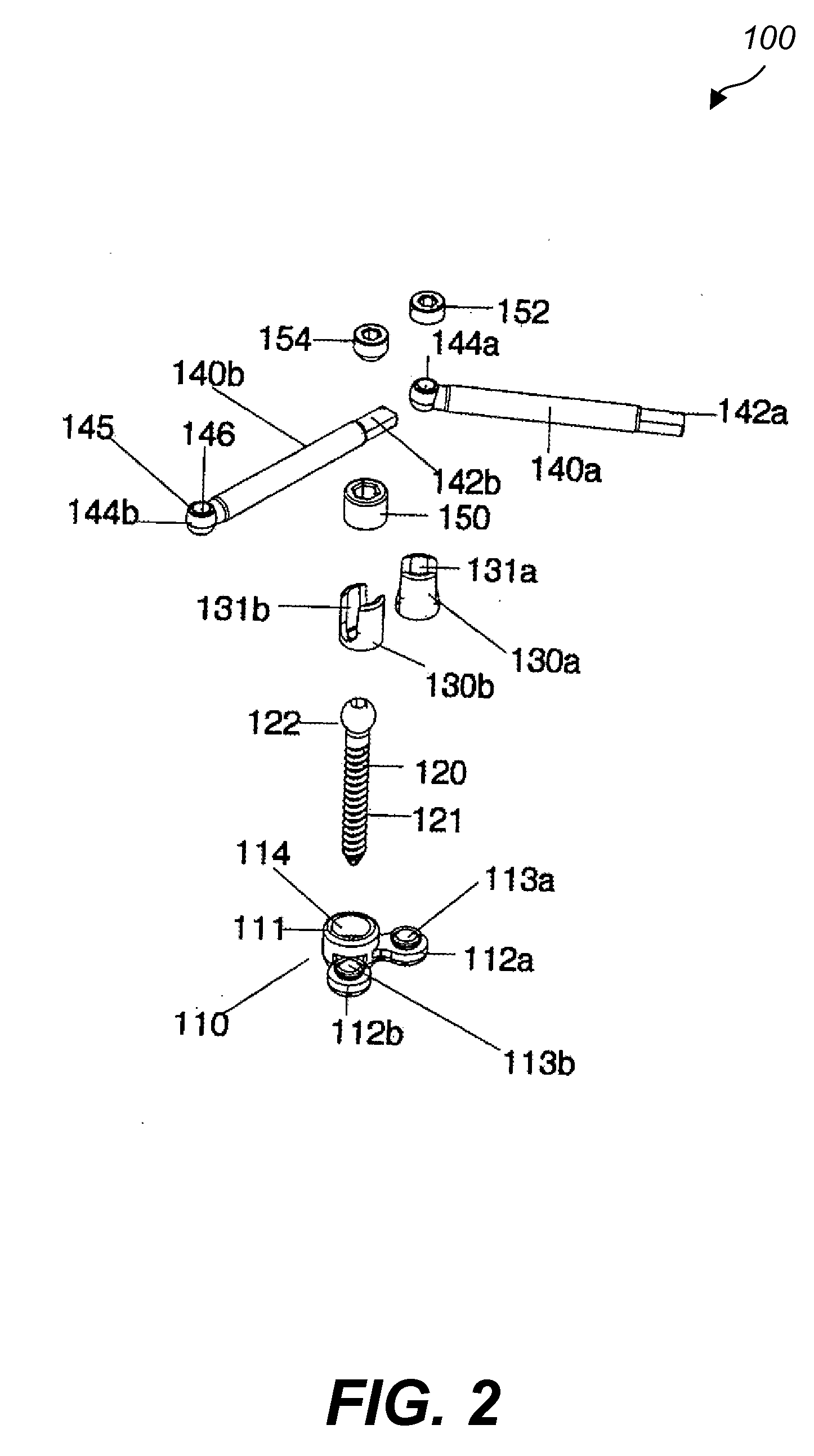 Spine fixation method and apparatus