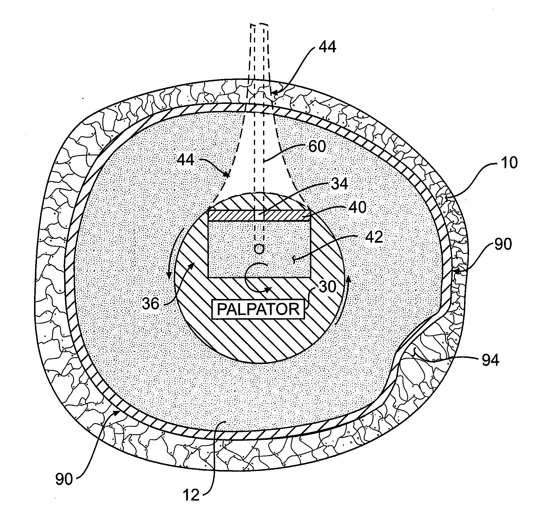 Optical coherence tomography catheter for elastographic property mapping of lumens utilizing micropalpation