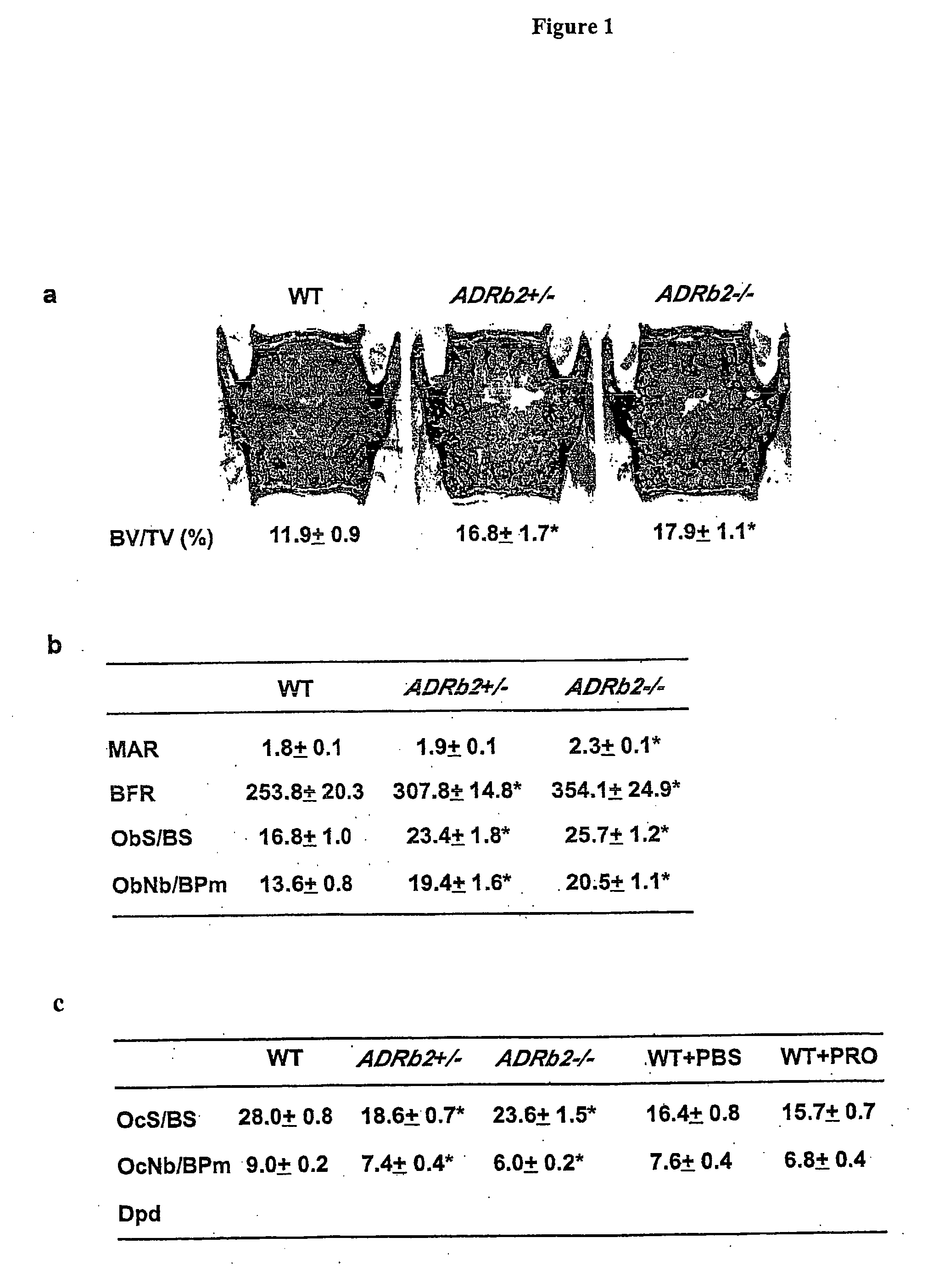 Compositions and methods for modulating bone mass