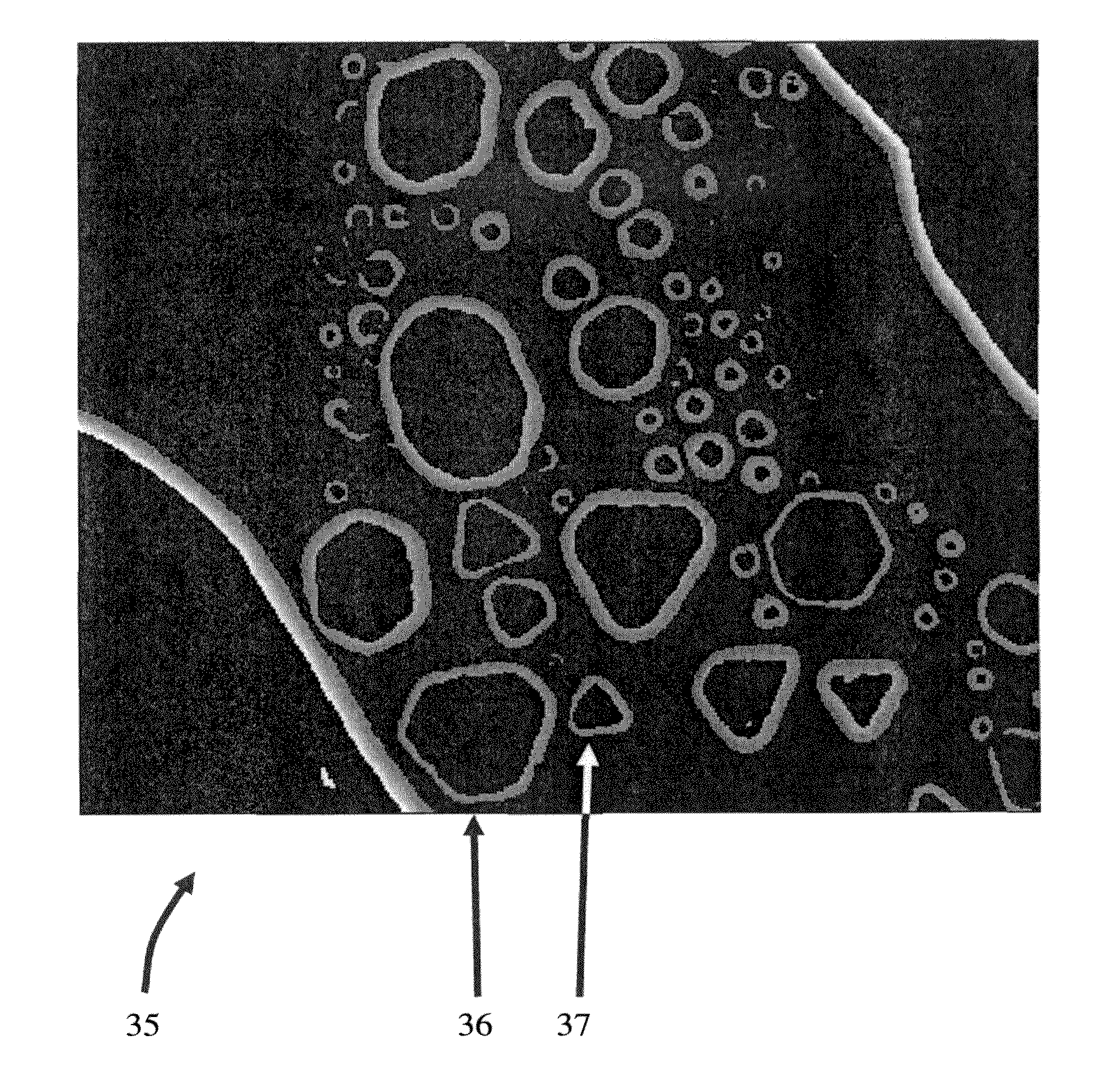 Method for processing a digital gray value image