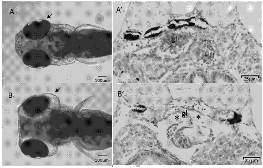 Method for evaluating kidney toxicity of compounds through detecting contents of creatinine in zebra fish tissues