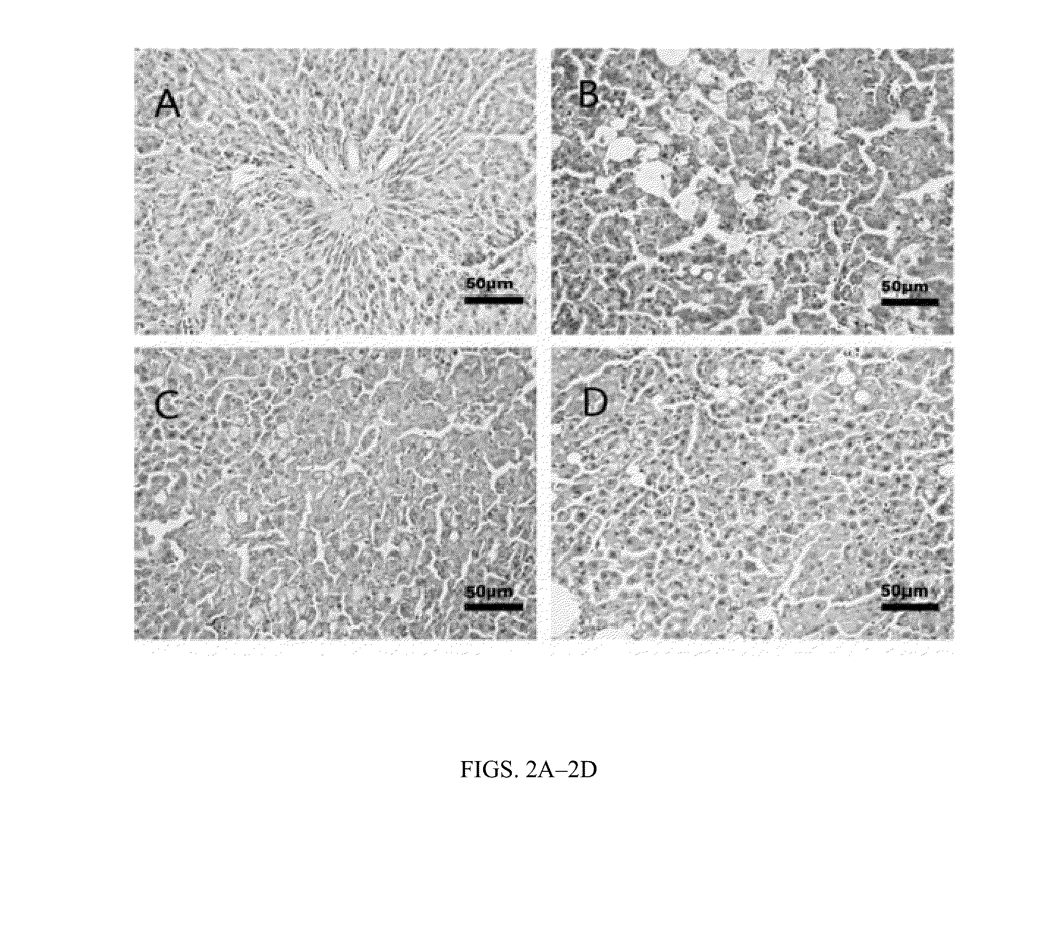 Modified green tea polyphenols and methods thereof for treating liver disease