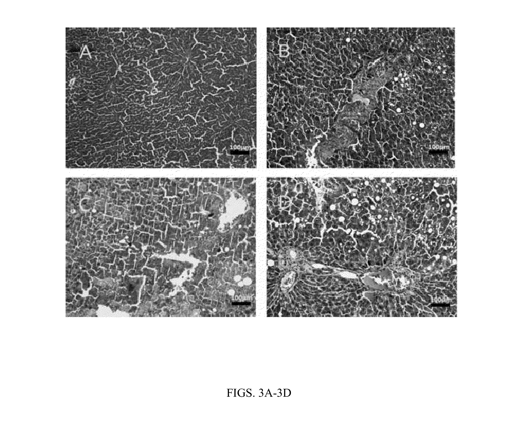 Modified green tea polyphenols and methods thereof for treating liver disease