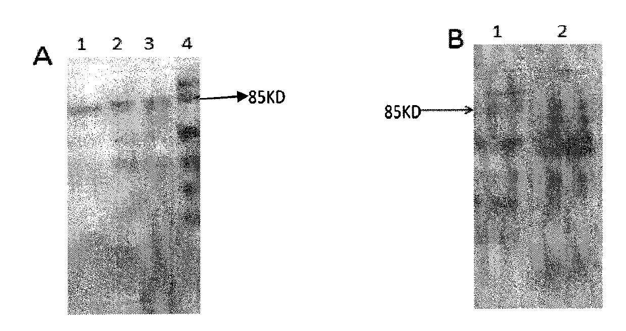Preparation and application of IL-15 isoform protein of mice