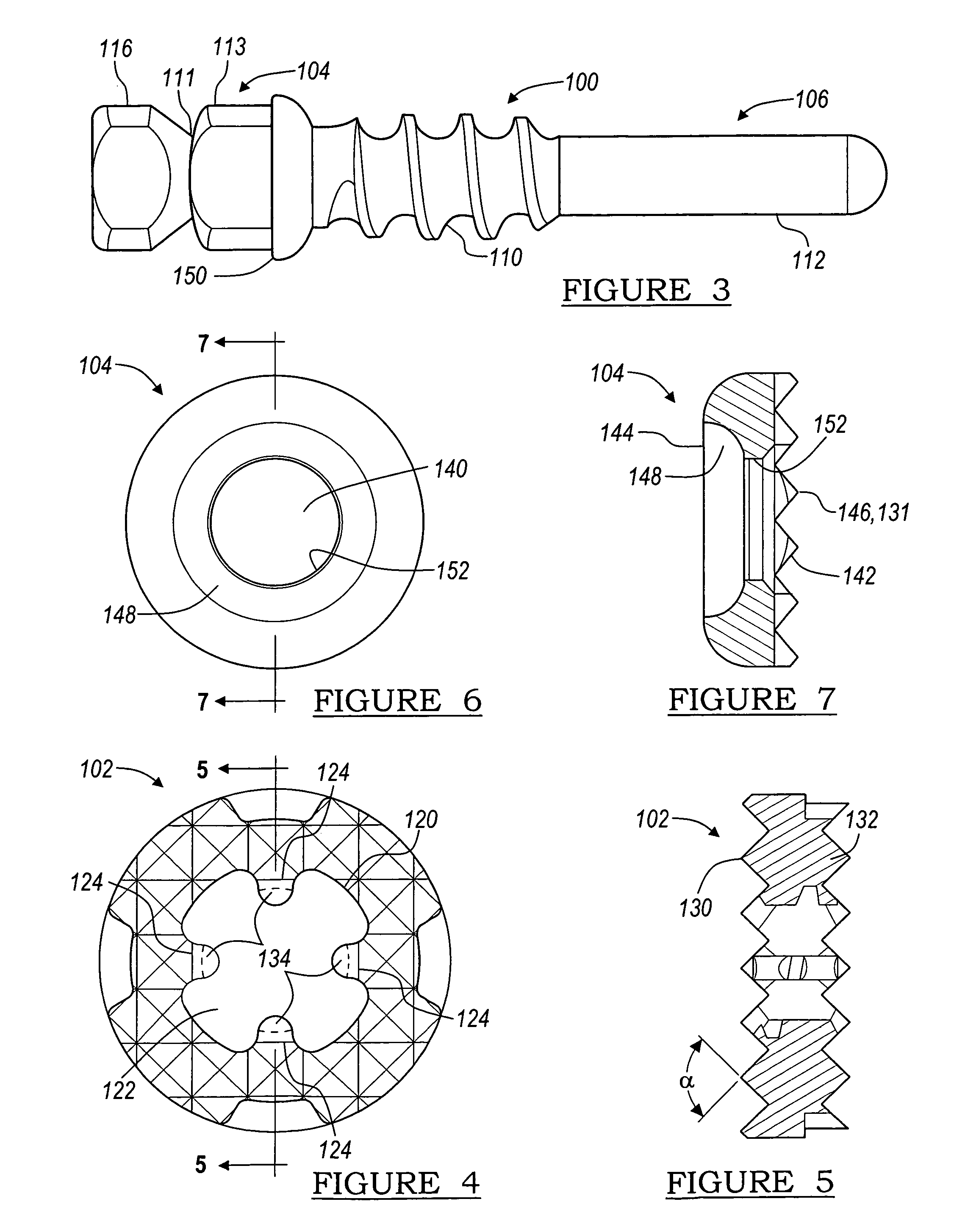 Device and method of fastening a graft to a bone