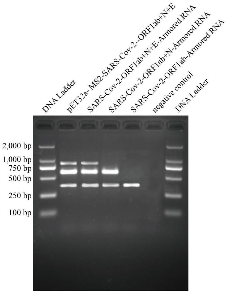 Reagent and method for detecting novel coronavirus