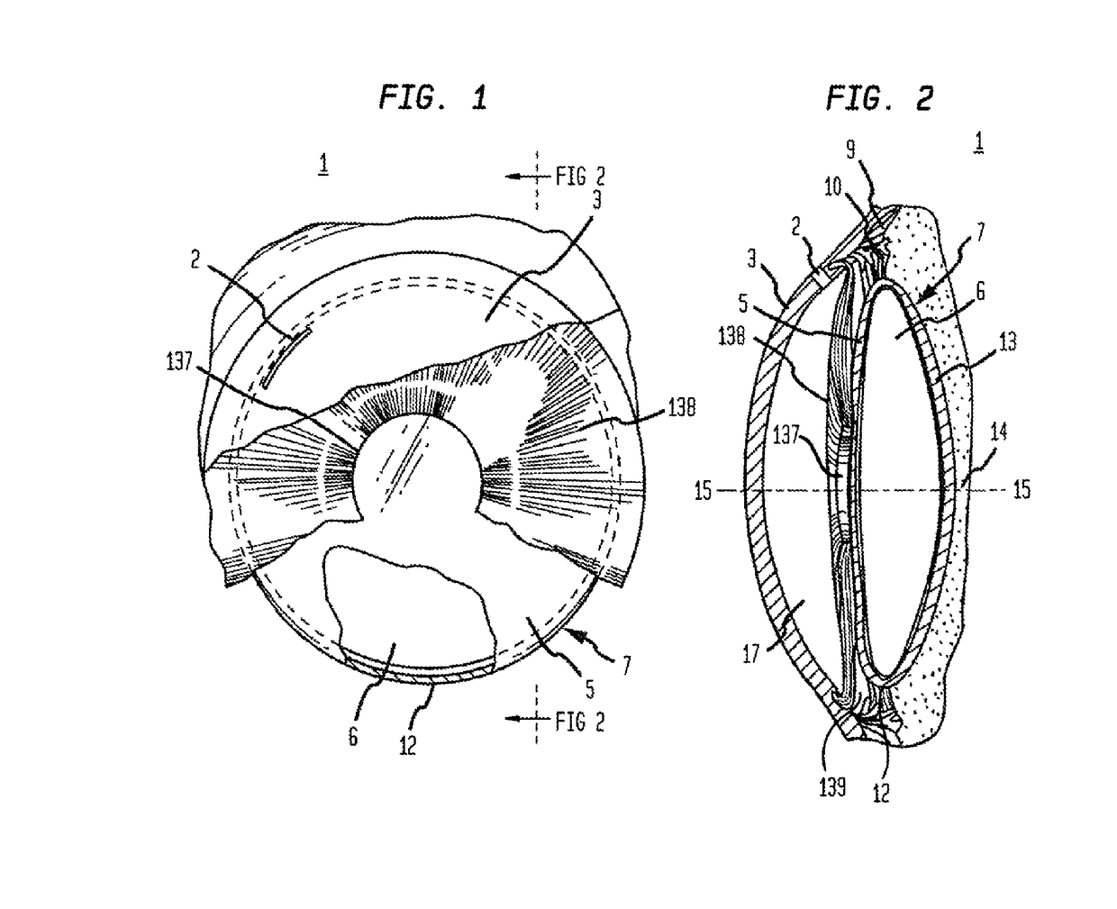 Micropatterned intraocular implants