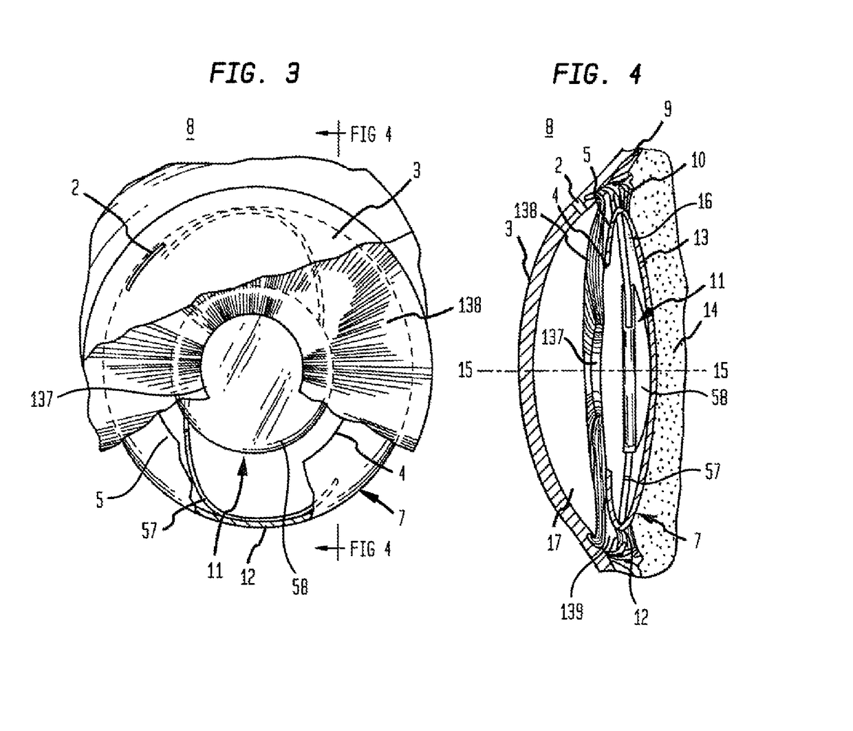 Micropatterned intraocular implants