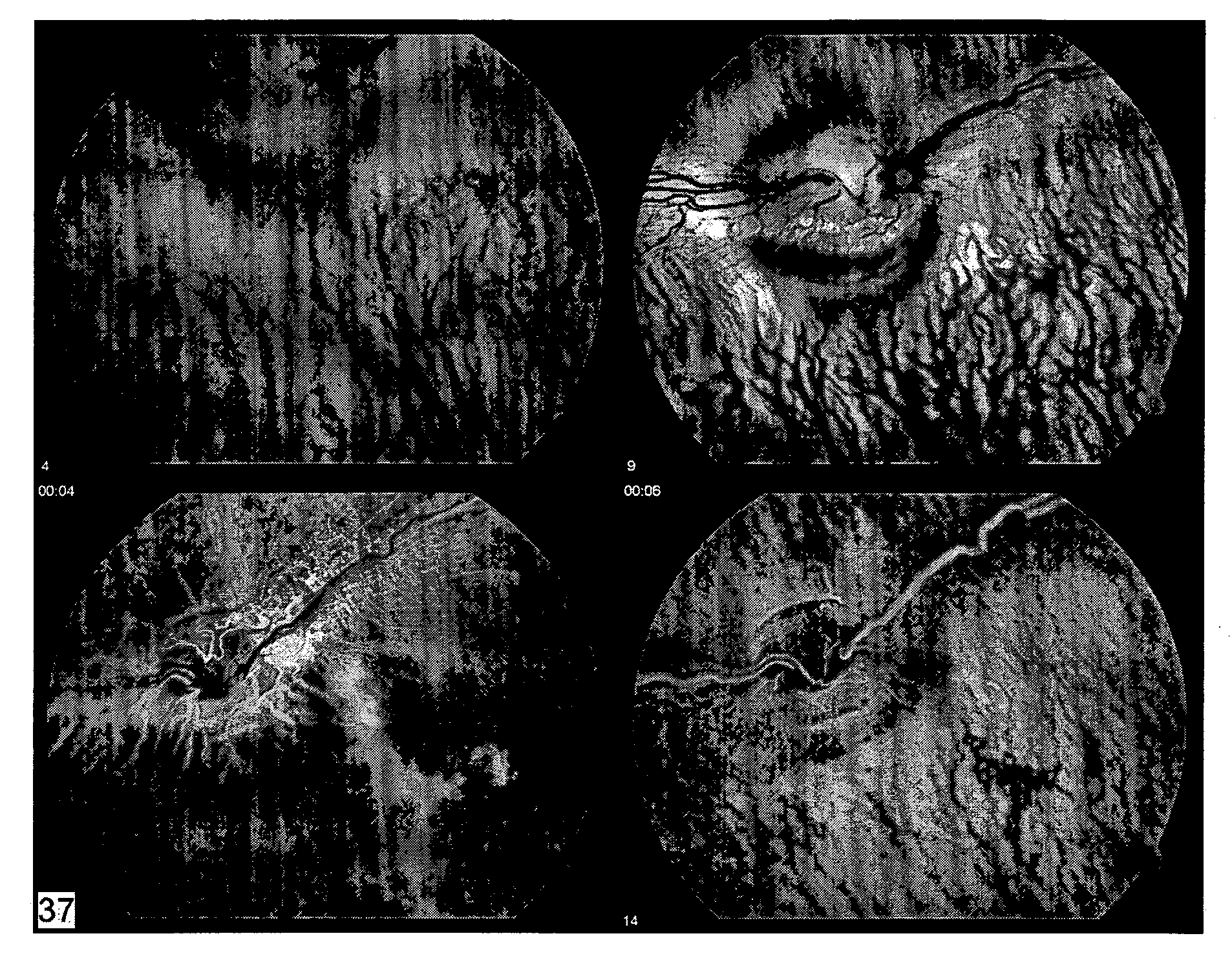 Compositions and methods for treating ophthalmic disorders