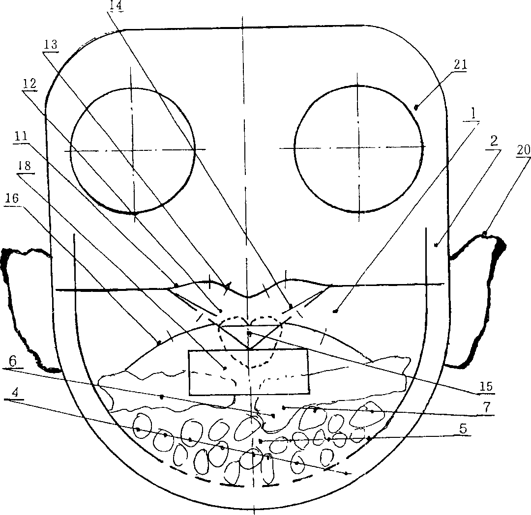 Nasal-rest type caller