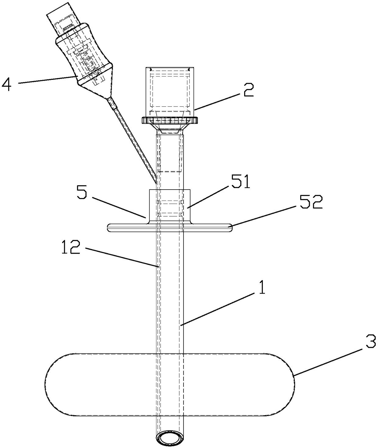 Device for replacement of stomach and intestine fistula
