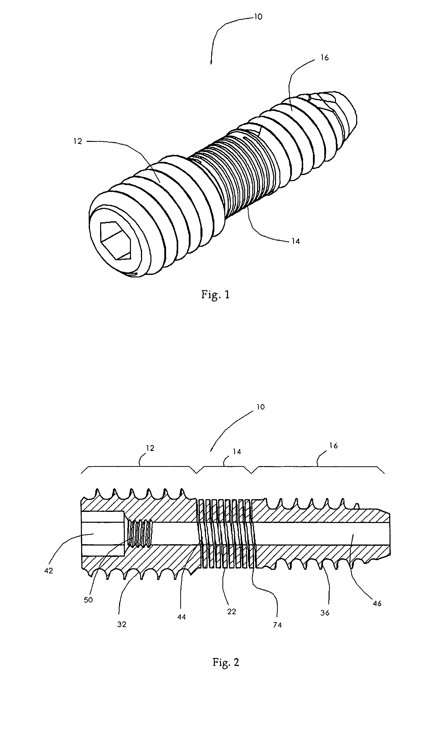 Spinal mobility preservation apparatus having an expandable membrane