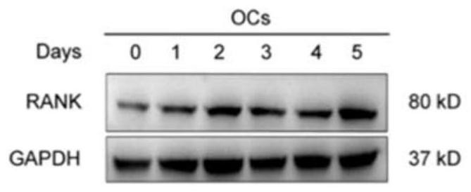 Osteoclast vesicles triggered by pH regulation in closed region and application thereof