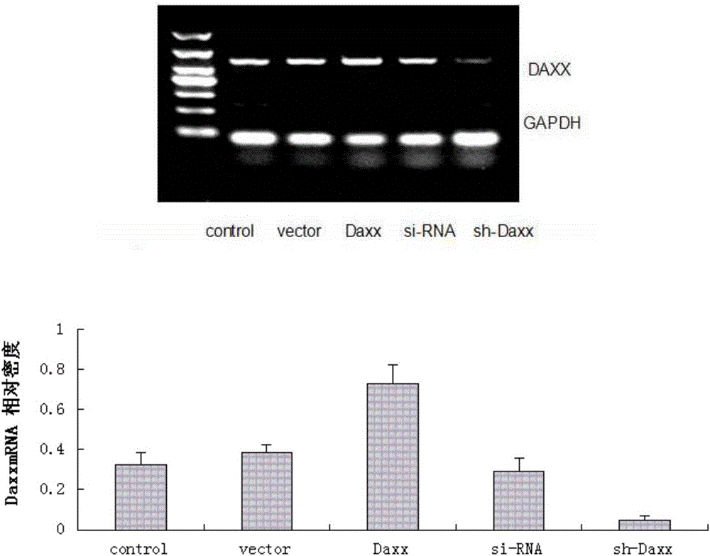 Application of death domain-associated protein in preparation of medicament for preventing and treating diseases related to vascular smooth muscle cell proliferation and/or vascular smooth muscle cell migration