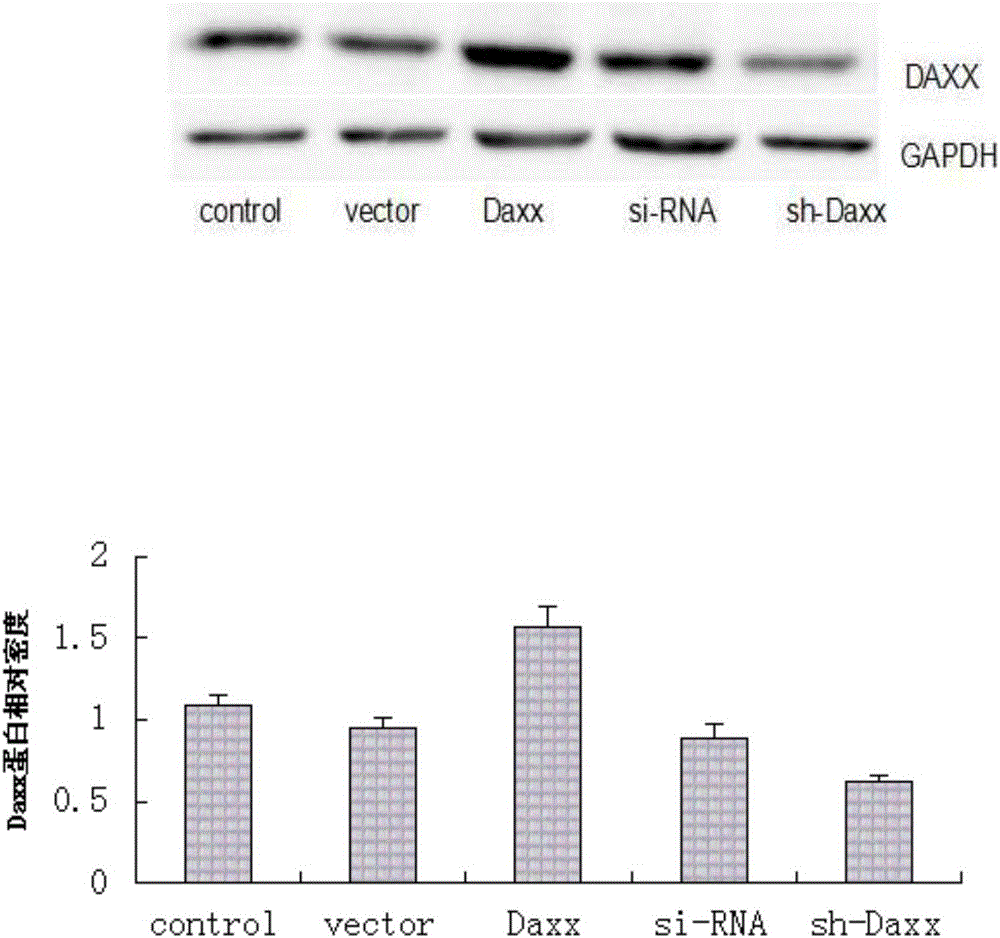 Application of death domain-associated protein in preparation of medicament for preventing and treating diseases related to vascular smooth muscle cell proliferation and/or vascular smooth muscle cell migration