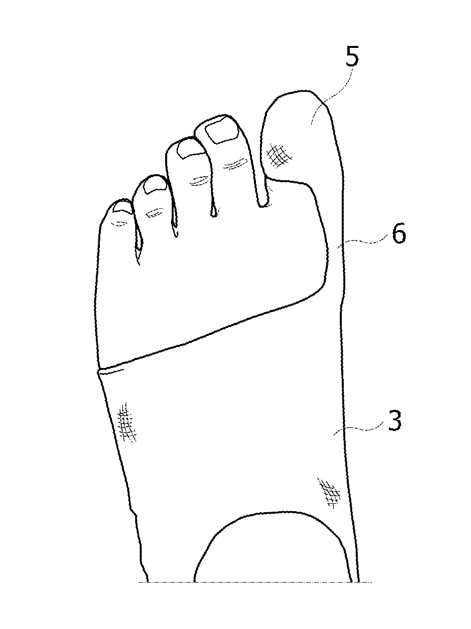 Orthopedic device for the mechanical treatment of hallux valgus