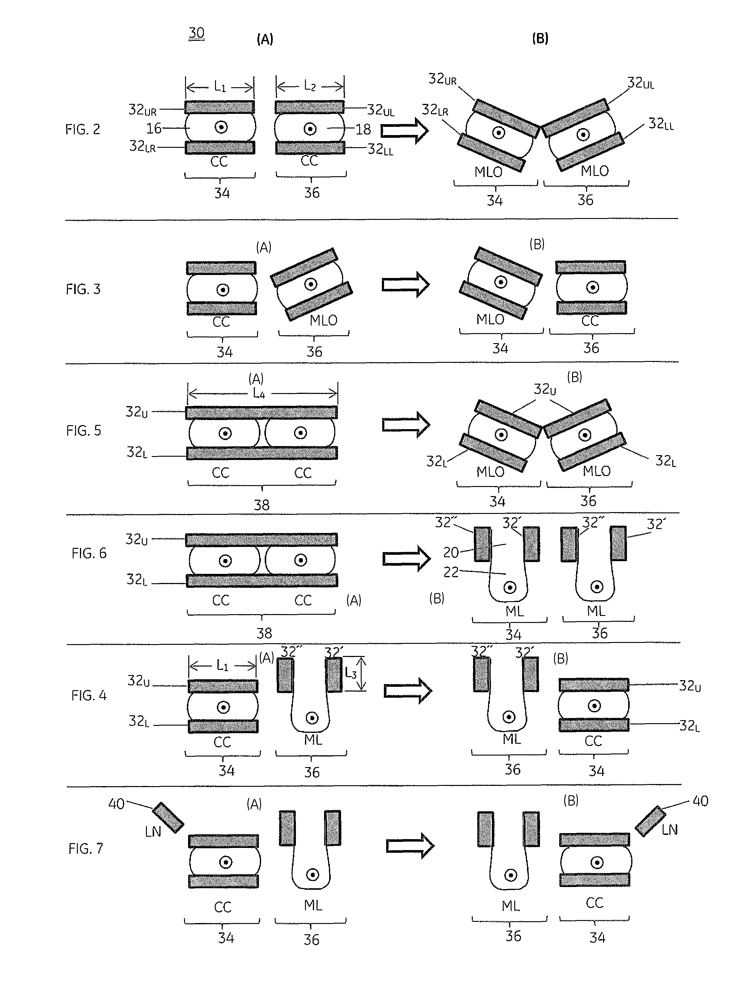 Apparatus and method for reducing examination time in molecular breast imaging