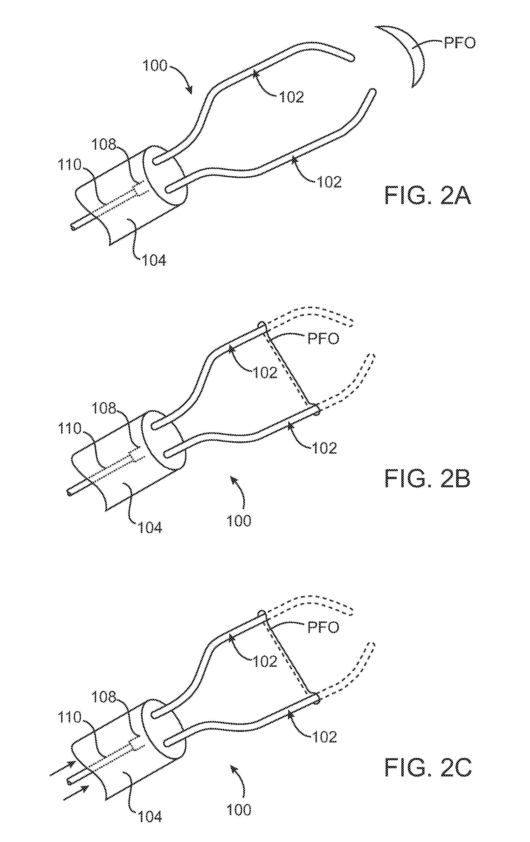 Methods and apparatus for closing a layered tissue defect