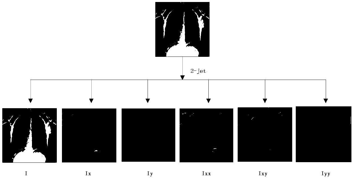 Bone inhibition method in chest X-ray image