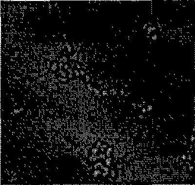 Use of daphne primeverose-genkwanin and daphne plant