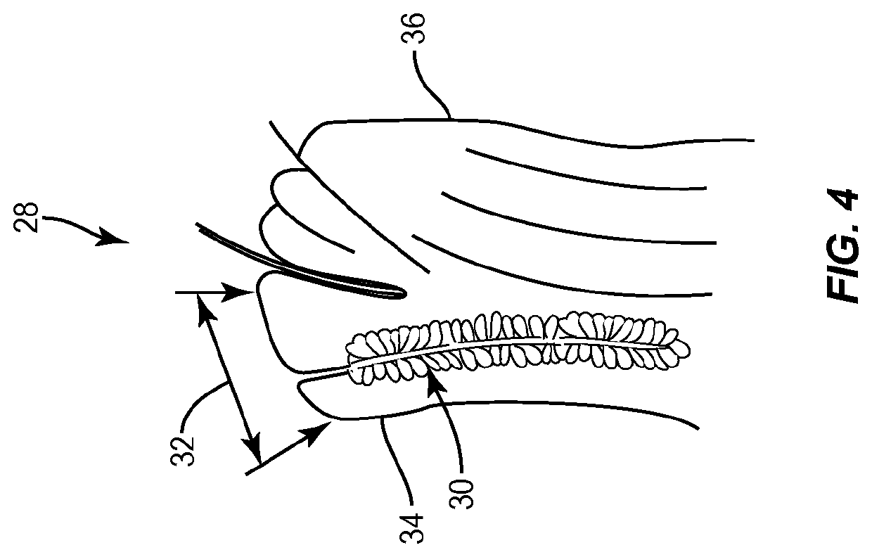 Apparatuses and methods for diagnosing and/or treating lipid transport deficiency in ocular tear films, and related components and devices