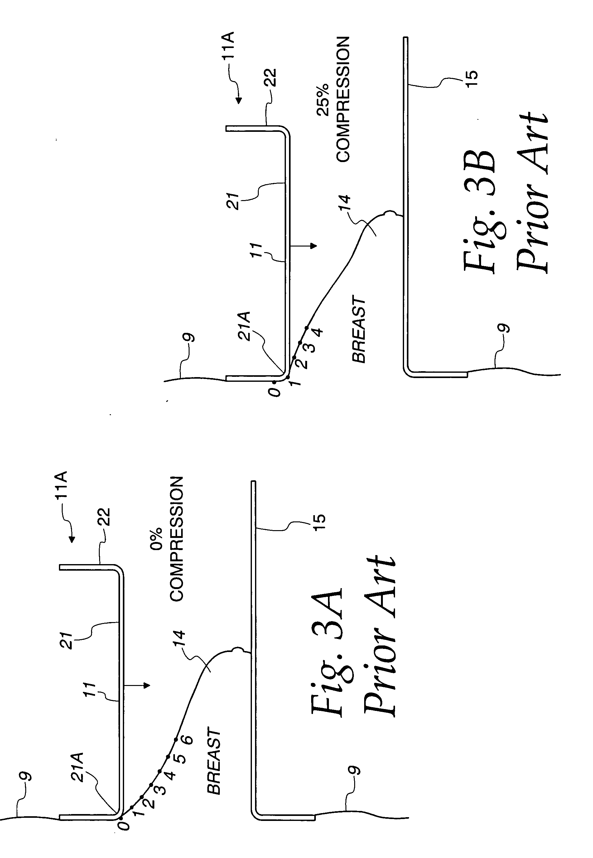 Method and apparatus for x-ray mammography imaging